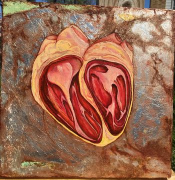 2 chamber heart defect: oil painting on gold/silver leaf ground
