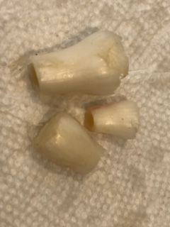 Immature garlic bulbs-not necessary to peel
