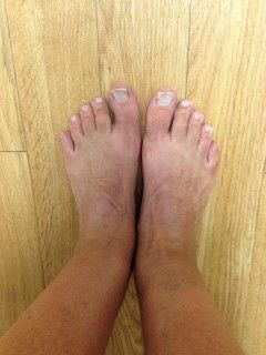 IMG_10511 Normal Feet
