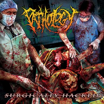 "Surgically Hacked AKA The Demo"Release Date: September 2006 Amputated Vein Records/2021 Nuclear BlastTrack List:1. Impious Brain Donor 2.Demented Betrayal3. Septic Shock4. Unsuspecting Poltergeist Possession5. As The Globe Begins To Burn6. Surgically Dismembered7. Braining8. Postorbital Incision9. The Abysmal Den10. Second Dimensional Apparition
