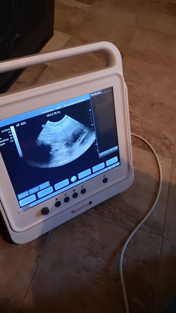 2/2/21  34 days ultrasound
