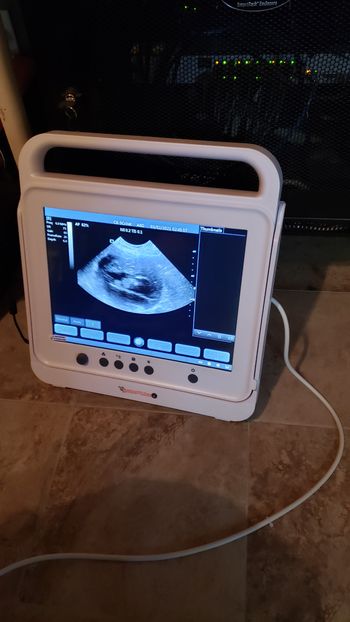 2/2/21  42 days ultrasound
