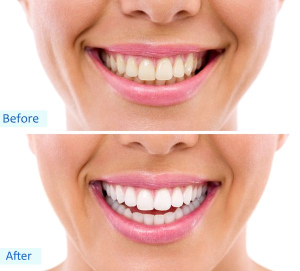 Before....and after!