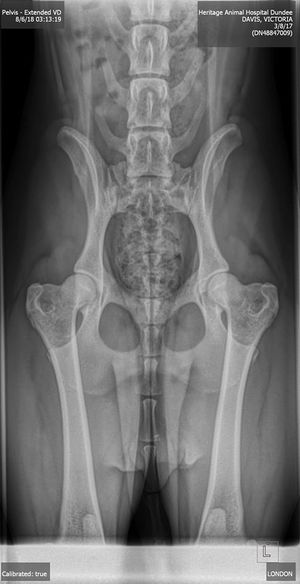 London's Hips (Done at 17 mo)