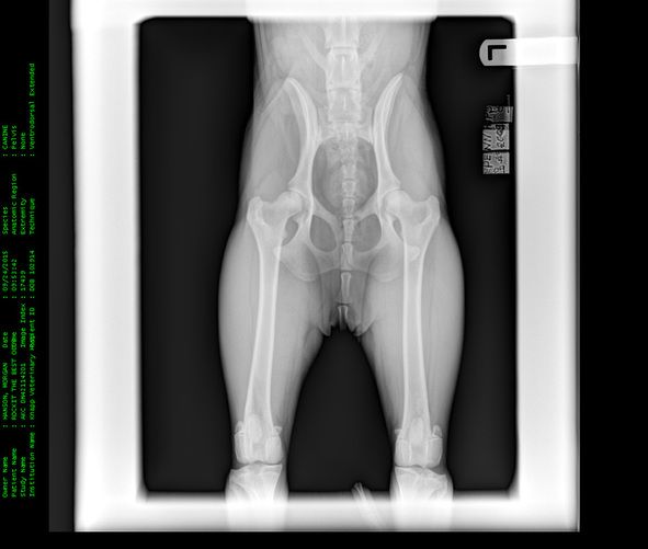 Winning's hip x-ray (done at 10 months)