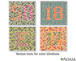 Tests-for-color-blindness from NIM.NIH.gov
