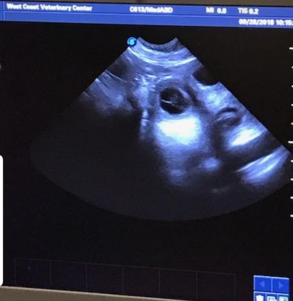 Day 28 Ultrasound confirms pregnancy with Joon & General!! Were so excited!