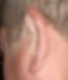 This is not a pornographic image. It is Steve Knuuti's ear!
