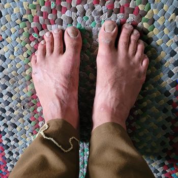 Hobbit feet
