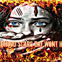 Childhood Scars Dat Wont Heal (SEASON ?) by Tireo