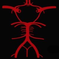 Circle of Willis by Roger!