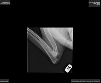 Clara Right Elbow
