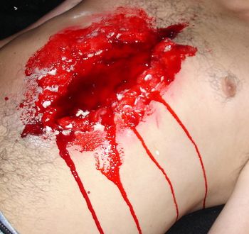 Chest wound "ACONITE"
