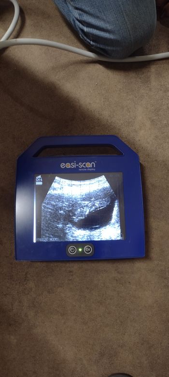 Ultrasound 07/18/22
