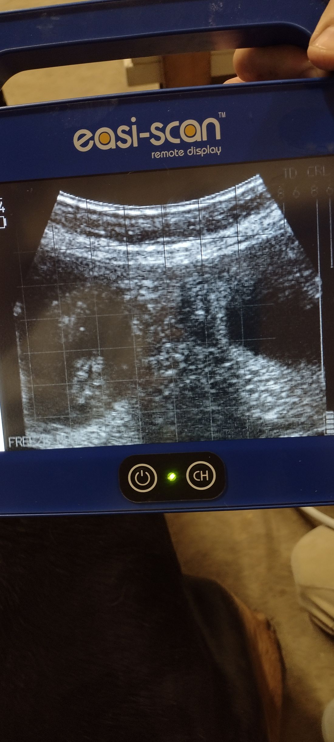 12/29/22  37 days ultrasound
