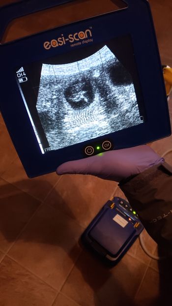 ultrasound at 32 days 10/19/20
