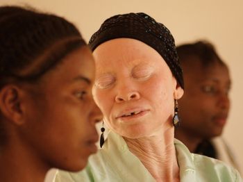 Photoshoot for Tanzania Albinism Collective

