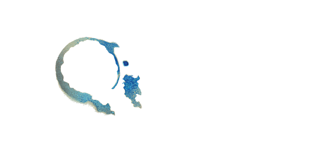 Izi Phoenix