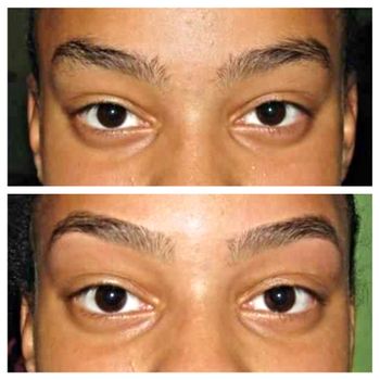 Brows before & after
